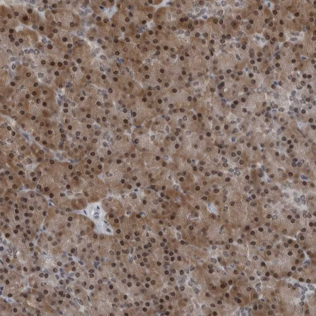 AKR1A1 Antibody in Immunohistochemistry (Paraffin) (IHC (P))