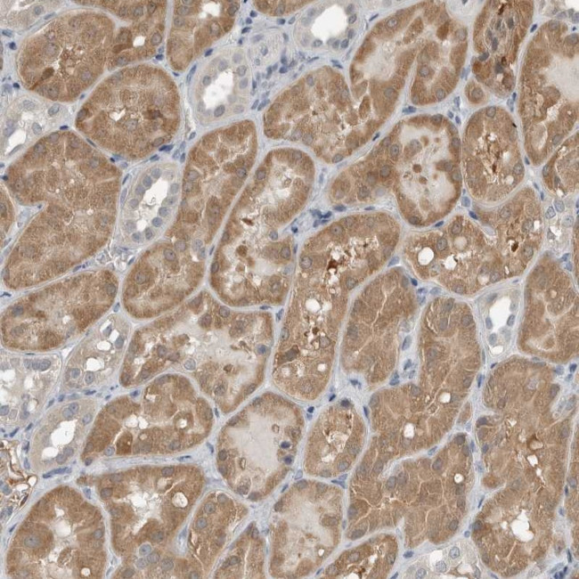 CCBL1 Antibody in Immunohistochemistry (Paraffin) (IHC (P))