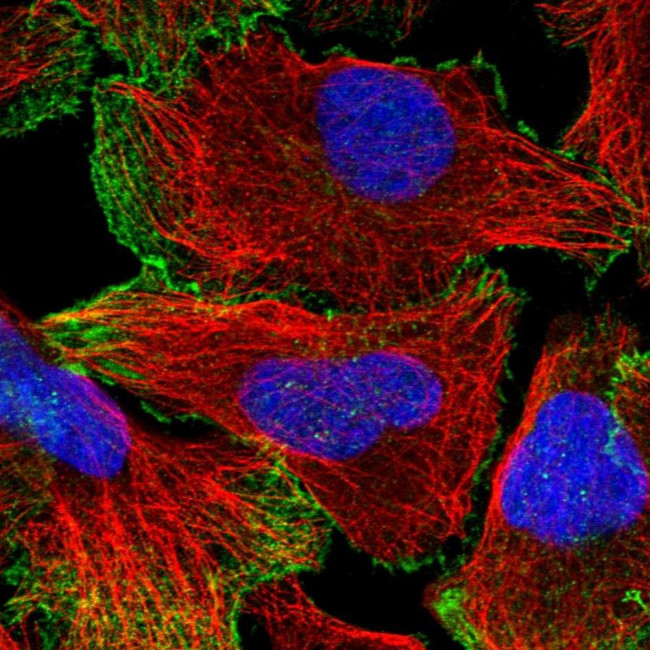 Neogenin Antibody in Immunocytochemistry (ICC/IF)