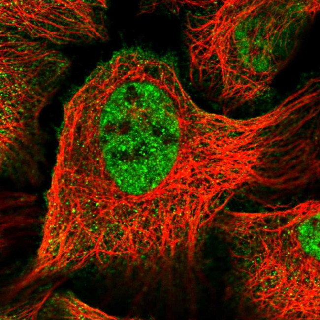 UBR2 Antibody in Immunocytochemistry (ICC/IF)