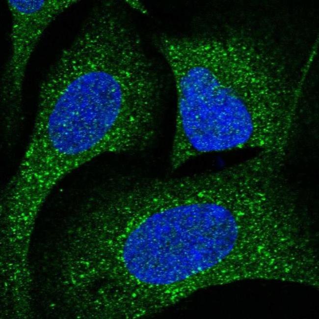 CDK5RAP3 Antibody in Immunocytochemistry (ICC/IF)