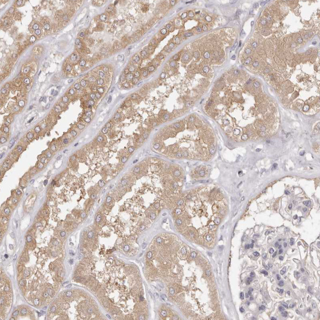 EEF1E1 Antibody in Immunohistochemistry (Paraffin) (IHC (P))