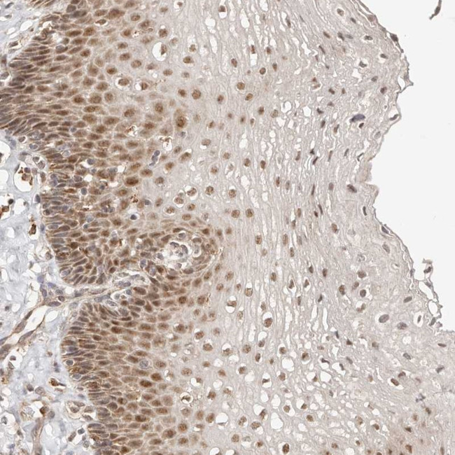 CTNNBL1 Antibody in Immunohistochemistry (Paraffin) (IHC (P))