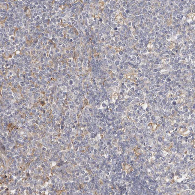 MSRB2 Antibody in Immunohistochemistry (Paraffin) (IHC (P))