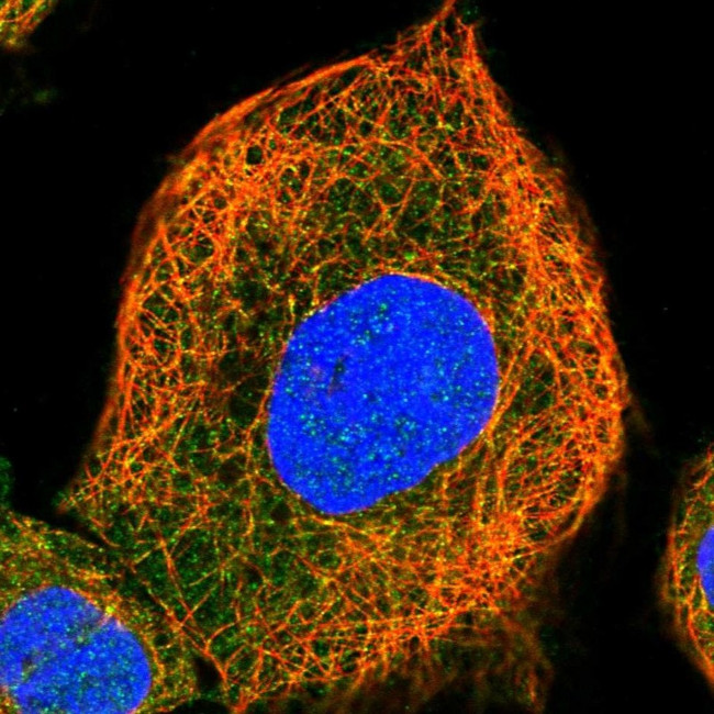 AIDA Antibody in Immunocytochemistry (ICC/IF)