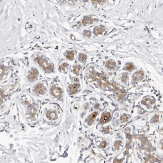 ODF2L Antibody in Immunohistochemistry (Paraffin) (IHC (P))