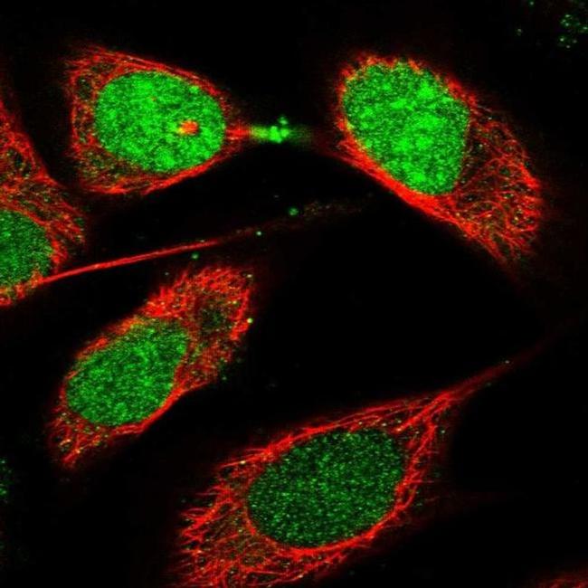 CDCA8 Antibody in Immunocytochemistry (ICC/IF)