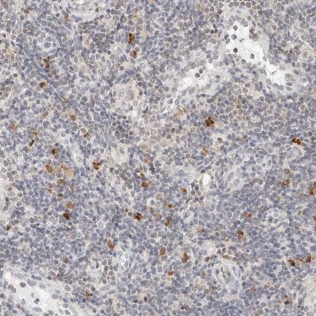 PARP10 Antibody in Immunohistochemistry (IHC)