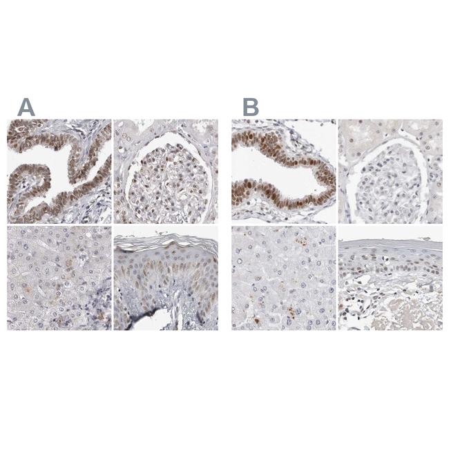 WRAP53 Antibody in Immunohistochemistry (IHC)