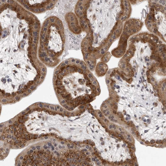 MRPS15 Antibody in Immunohistochemistry (Paraffin) (IHC (P))