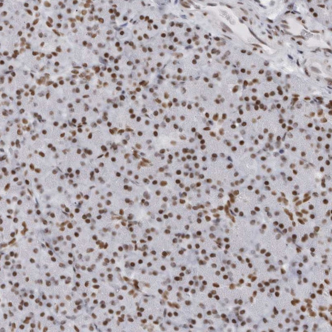 HP1BP3 Antibody in Immunohistochemistry (Paraffin) (IHC (P))