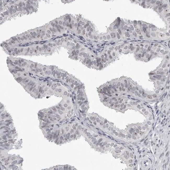 DDX54 Antibody in Immunohistochemistry (IHC)