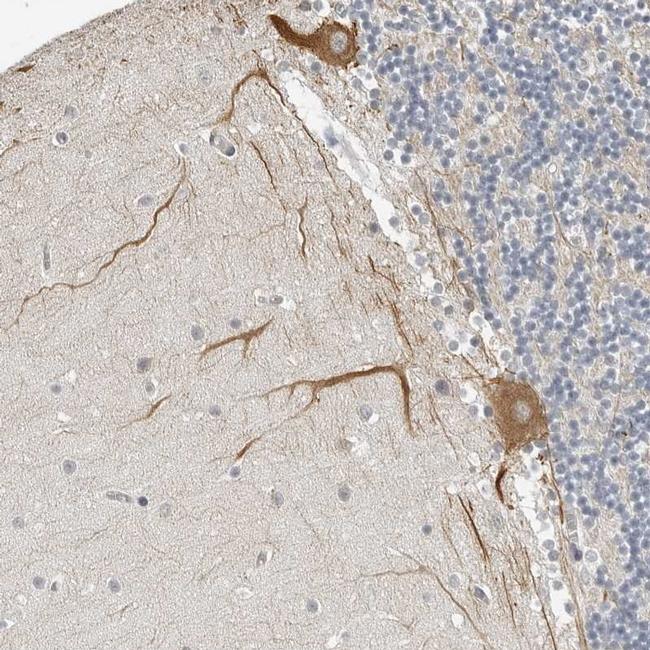 OPLAH Antibody in Immunohistochemistry (IHC)