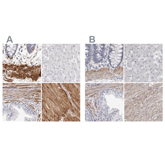 LMOD1 Antibody in Immunohistochemistry (IHC)