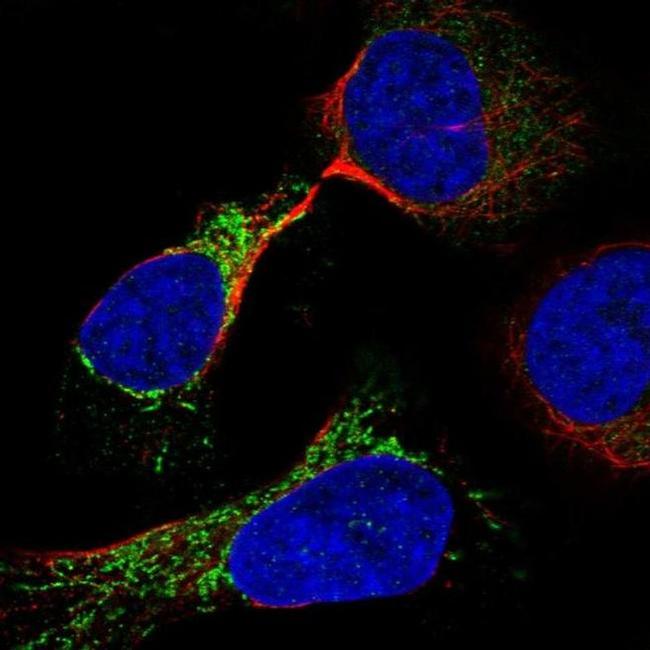 ODF2L Antibody in Immunocytochemistry (ICC/IF)