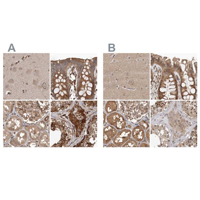 CEP350 Antibody in Immunohistochemistry (IHC)