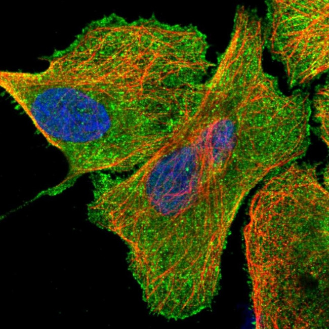 USP21 Antibody in Immunocytochemistry (ICC/IF)