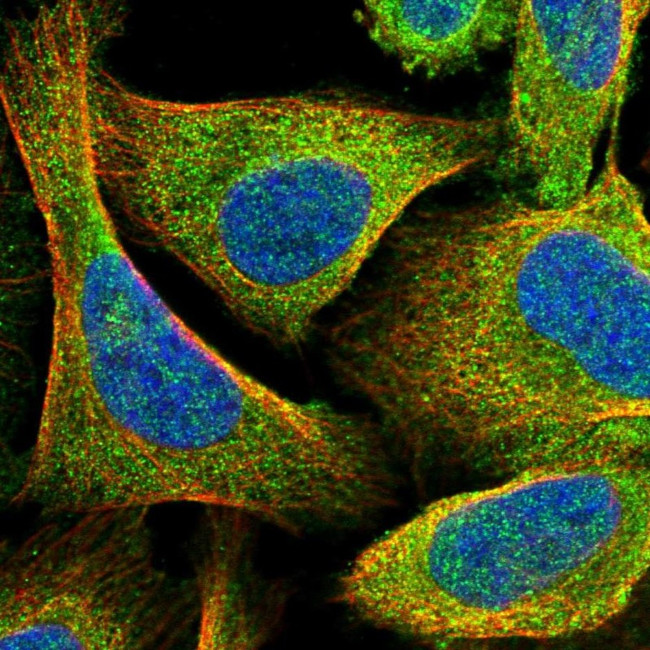 LMOD1 Antibody in Immunocytochemistry (ICC/IF)