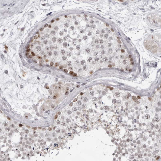 EXOSC10 Antibody in Immunohistochemistry (Paraffin) (IHC (P))