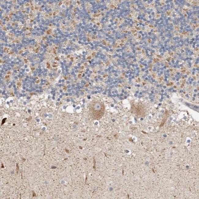 KIF26B Antibody in Immunohistochemistry (IHC)