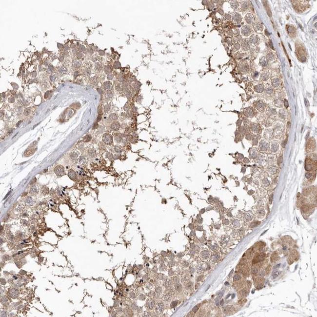 NSUN4 Antibody in Immunohistochemistry (IHC)