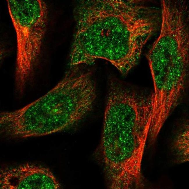 AGL Antibody in Immunocytochemistry (ICC/IF)