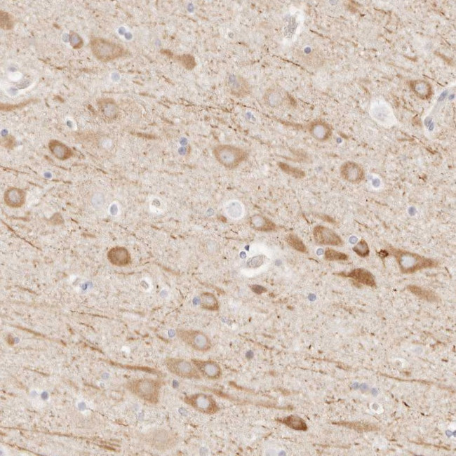 UBXN10 Antibody in Immunohistochemistry (Paraffin) (IHC (P))