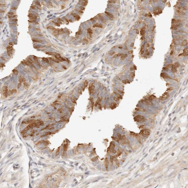 UBXN10 Antibody in Immunohistochemistry (Paraffin) (IHC (P))