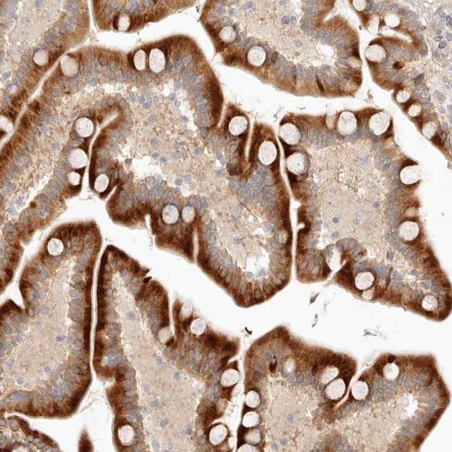 UBXD5 Antibody in Immunohistochemistry (IHC)