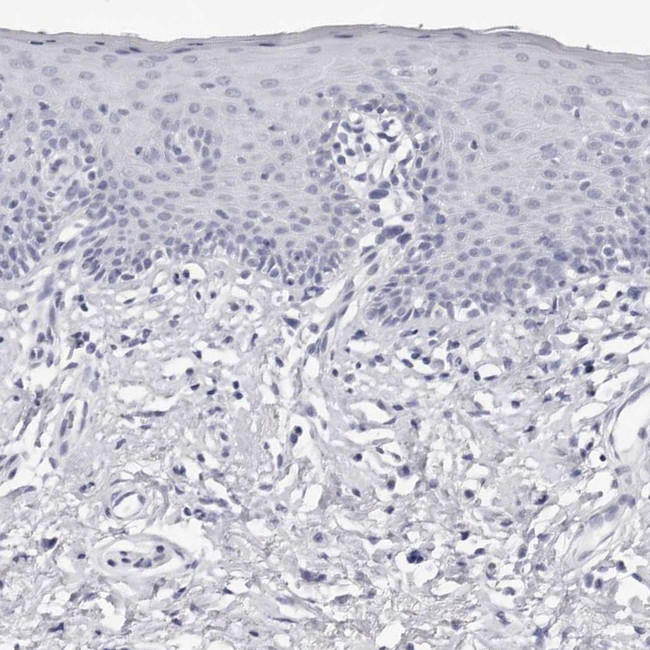 INSL3 Antibody in Immunohistochemistry (Paraffin) (IHC (P))