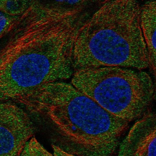 WDR65 Antibody in Immunocytochemistry (ICC/IF)