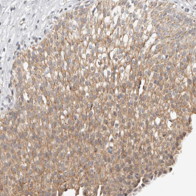 KDF1 Antibody in Immunohistochemistry (Paraffin) (IHC (P))