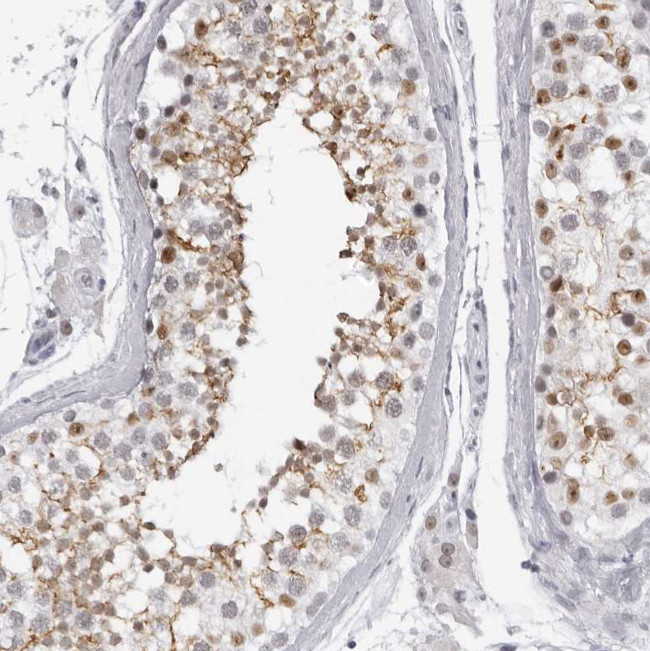 ESPN Antibody in Immunohistochemistry (Paraffin) (IHC (P))