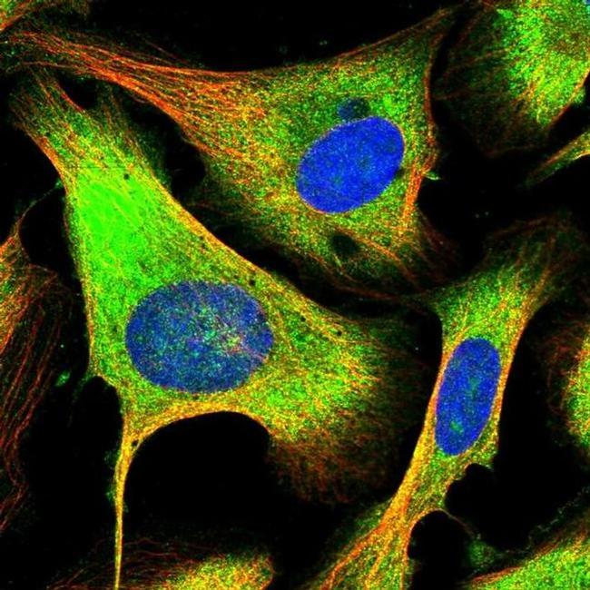 PFDN2 Antibody in Immunocytochemistry (ICC/IF)