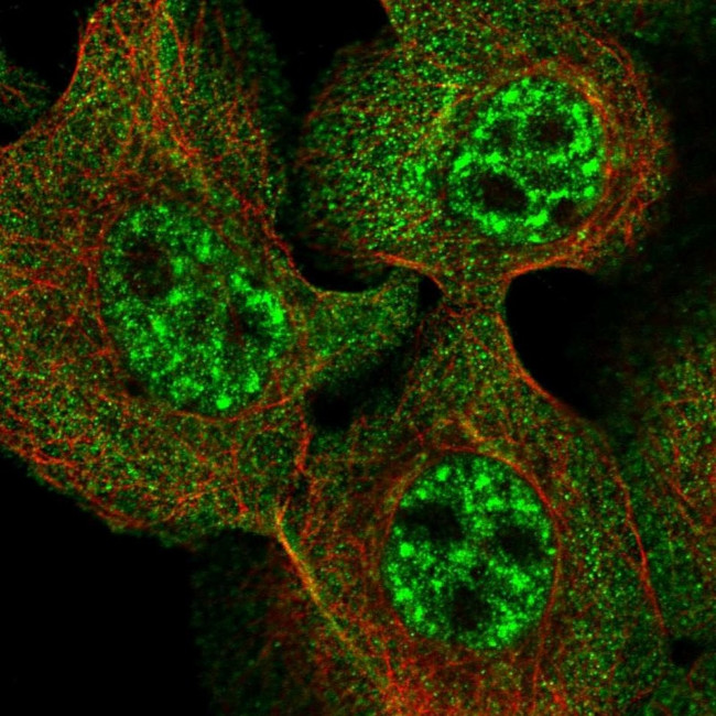 UFC1 Antibody in Immunocytochemistry (ICC/IF)