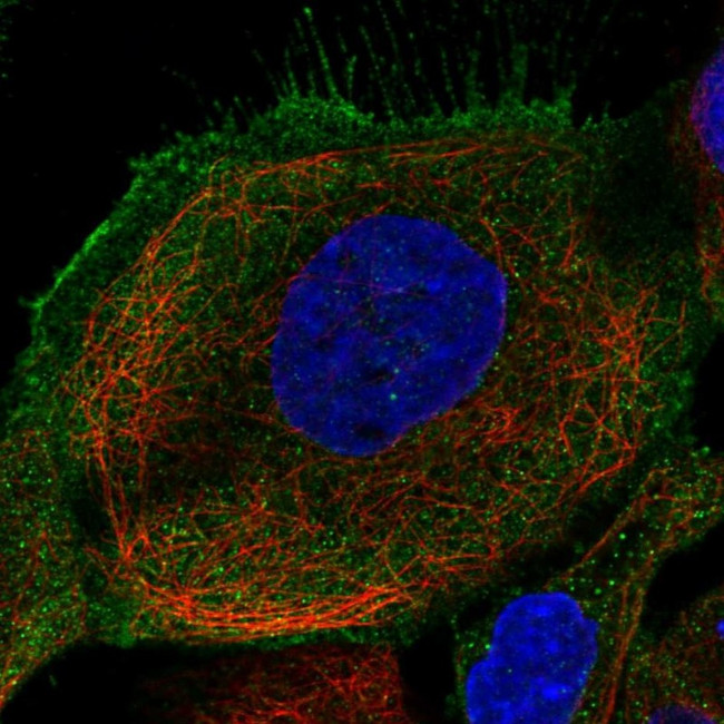 Folliculin Antibody in Immunocytochemistry (ICC/IF)