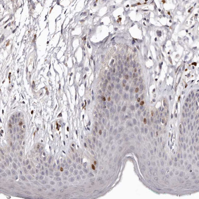 CDCA8 Antibody in Immunohistochemistry (Paraffin) (IHC (P))