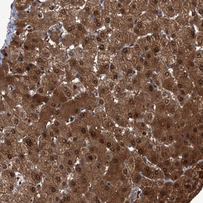 ZNF274 Antibody in Immunohistochemistry (Paraffin) (IHC (P))