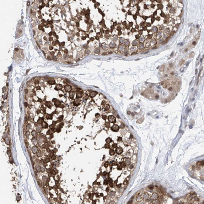 Centrin 2 Antibody in Immunohistochemistry (Paraffin) (IHC (P))