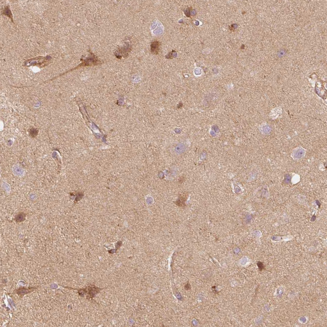 APLP1 Antibody in Immunohistochemistry (Paraffin) (IHC (P))