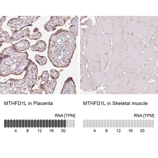 MTHFD1L Antibody in Immunohistochemistry (IHC)