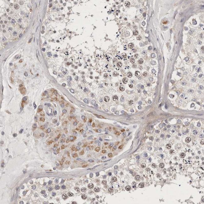 MRPS10 Antibody in Immunohistochemistry (Paraffin) (IHC (P))