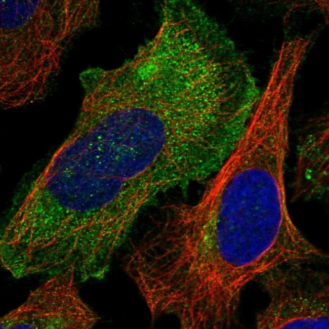 RAB23 Antibody in Immunocytochemistry (ICC/IF)