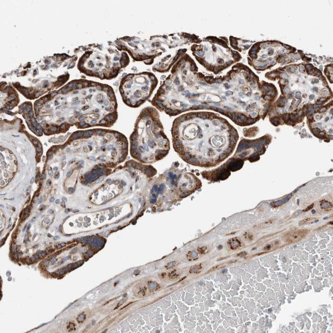 COG1 Antibody in Immunohistochemistry (Paraffin) (IHC (P))