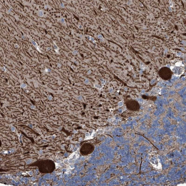 KIF13A Antibody in Immunohistochemistry (Paraffin) (IHC (P))