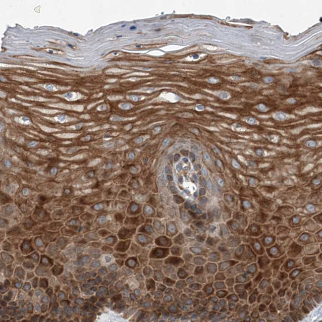 USP47 Antibody in Immunohistochemistry (Paraffin) (IHC (P))