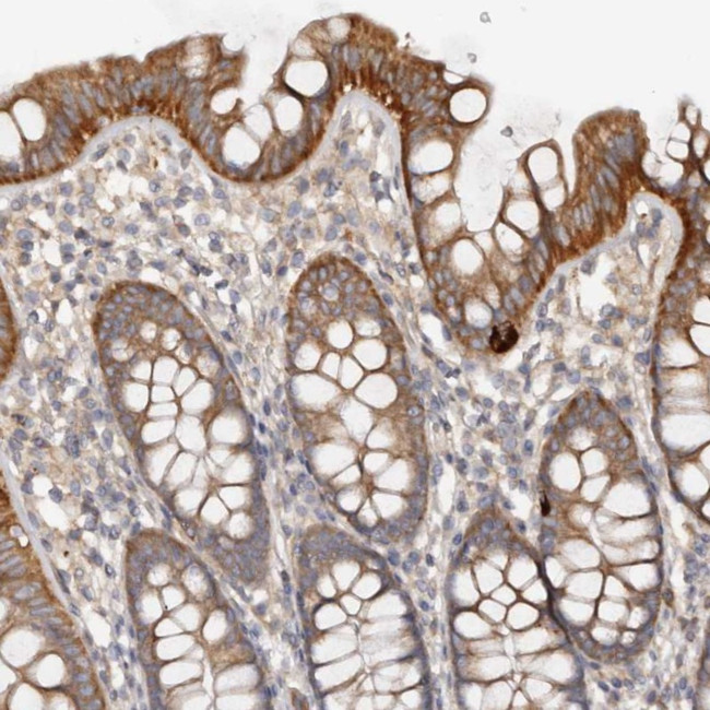 DMRT2 Antibody in Immunohistochemistry (Paraffin) (IHC (P))