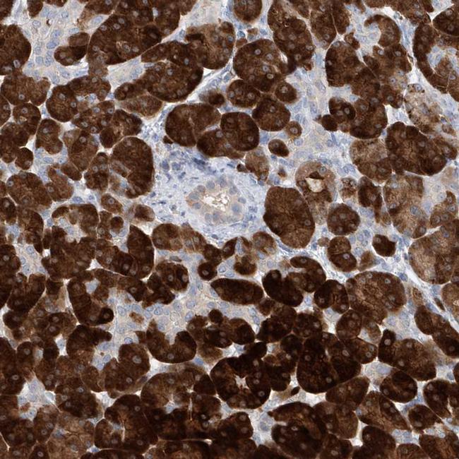 Asparagine Synthetase Antibody in Immunohistochemistry (IHC)