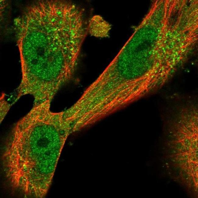 DMKN Antibody in Immunocytochemistry (ICC/IF)