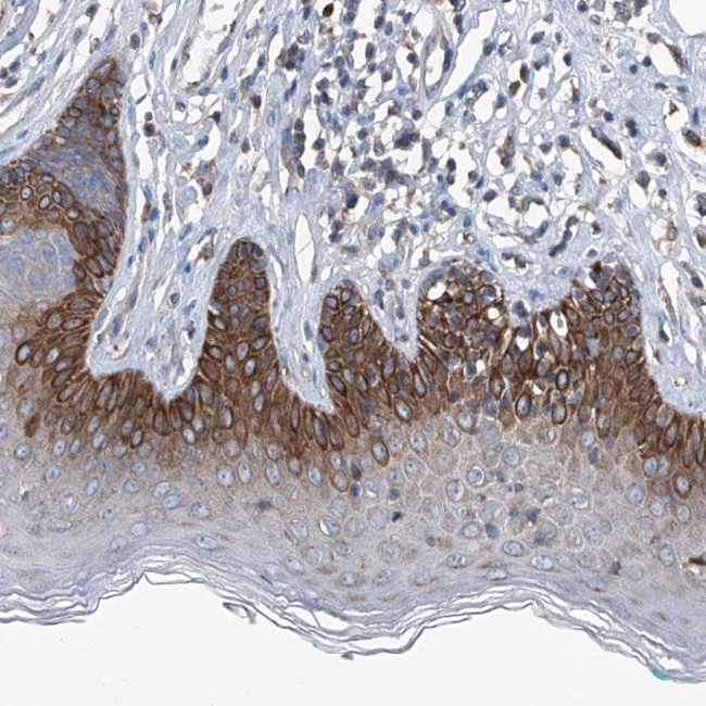 AGPAT9 Antibody in Immunohistochemistry (Paraffin) (IHC (P))